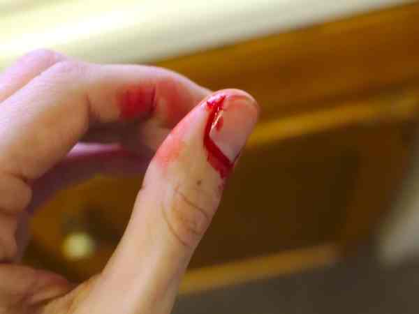 Hiện tượng mùng 1 chảy máu điềm gì?
